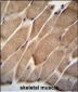 ELMO2 Antibody (Center)